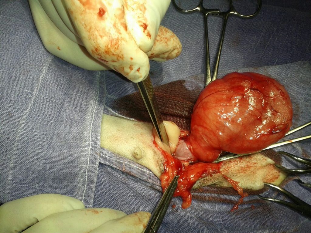 Der besondere Fall Leistenbruch mit Gebärmutter