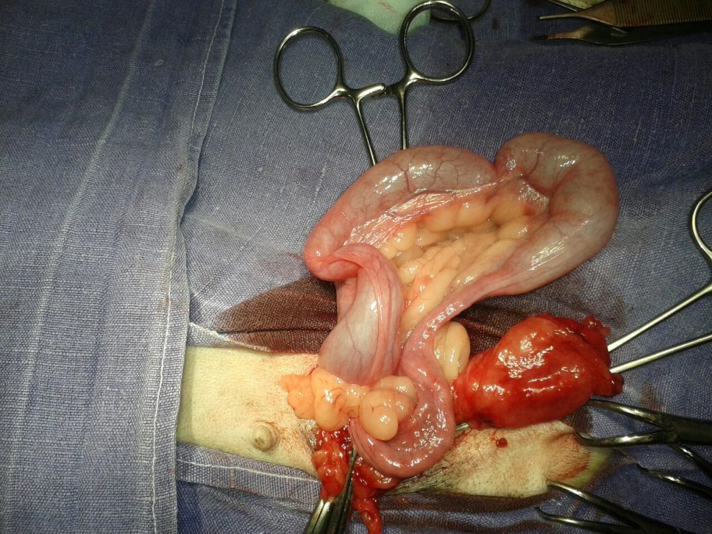 Der besondere Fall Leistenbruch mit Gebärmutter